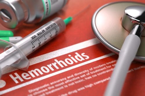 cycling and hemorrhoids